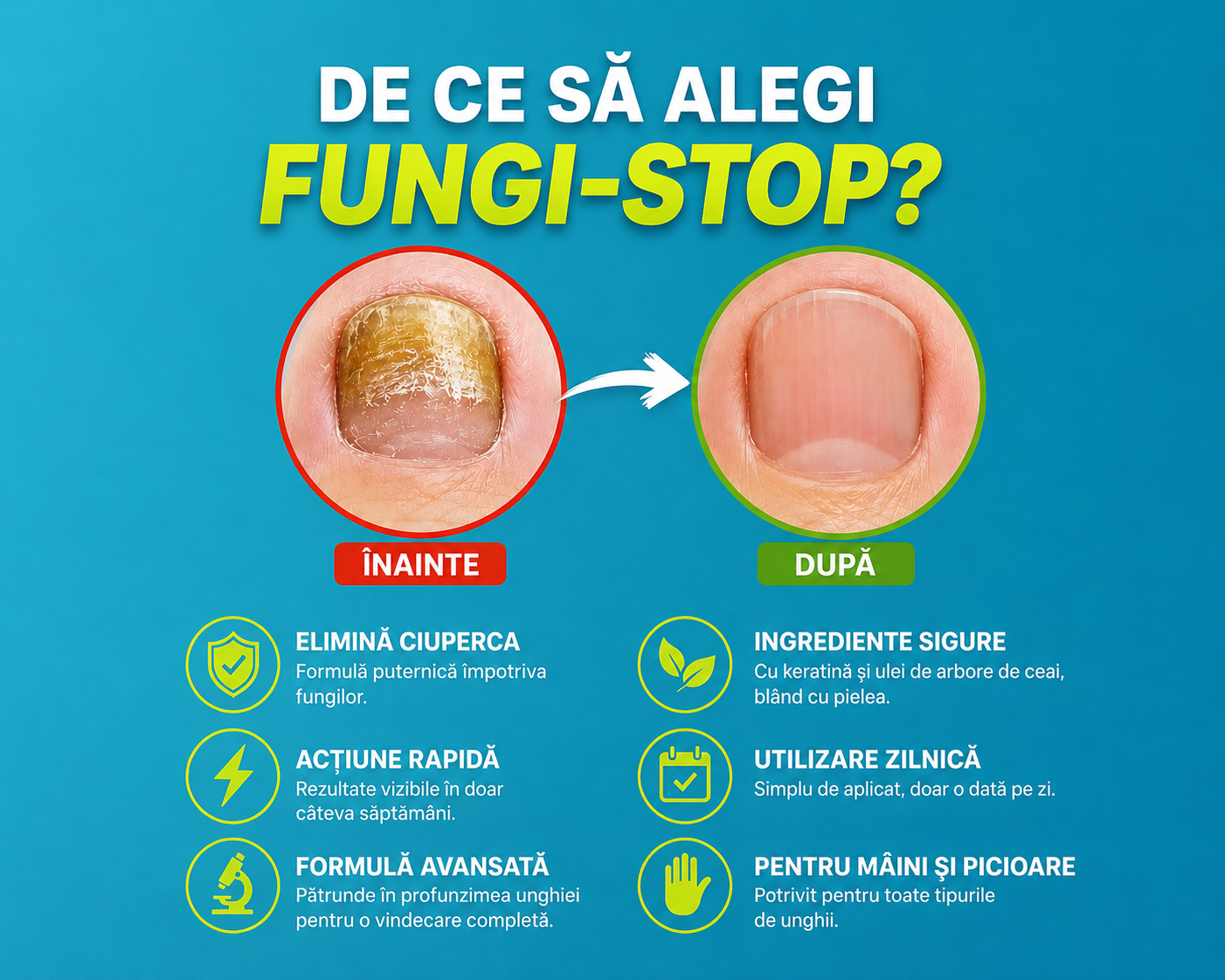 🍄 FUNGI-STOP – Gel pentru combaterea ciupercii unghiilor
